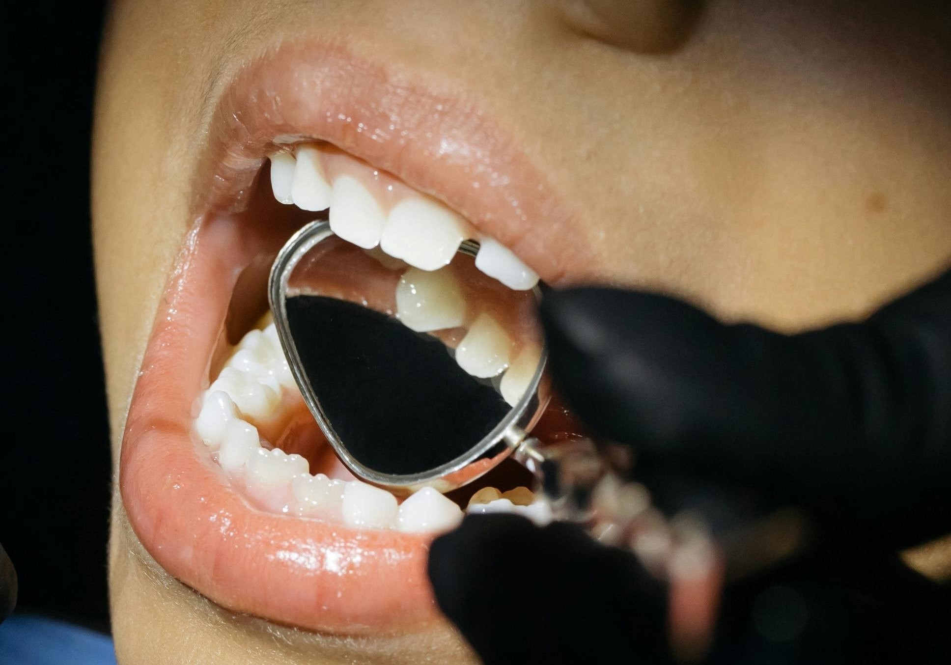 Pediatric Dentistry